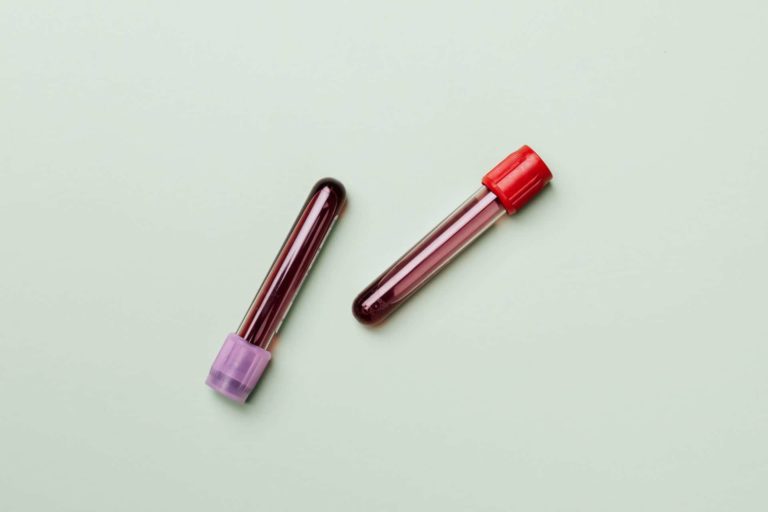 blood-samples-4047146