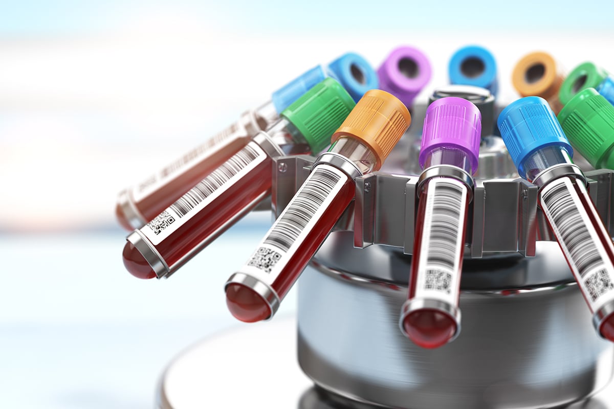 Vials of blood in blood tests for Celiac Disease