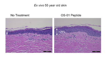 Ex vivo 55 year old skin