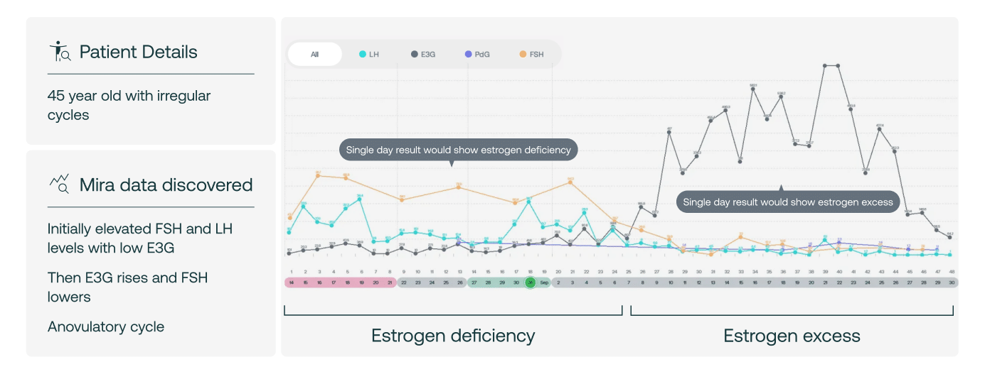A 45-year-old with two starkly different pictures depending on when you catch her: early on, low estrogen (black) paired with high FSH (yellow); later, the reverse — estrogen abnormally high, FSH low.